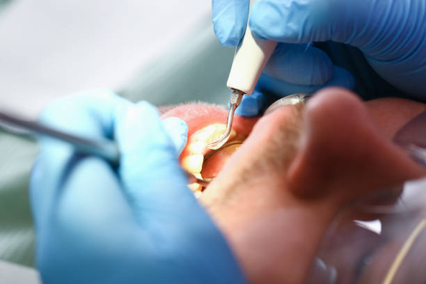 Best Emergency Tooth Extraction in Mountain Park, GA