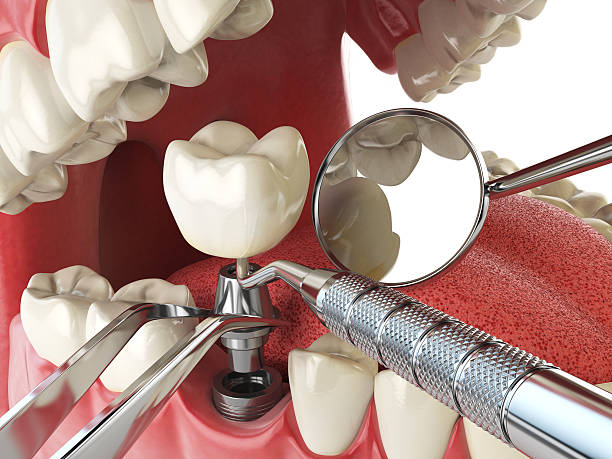 Best Emergency Treatment for Toothache in Mountain Park, GA